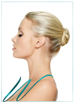 Nose Job (Rhinoplasty) Beverly Hills Picture